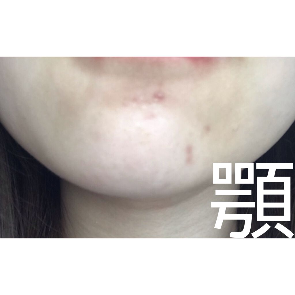 サンシビオ エイチツーオー D/ビオデルマ/クレンジングウォーターを使ったクチコミ(6枚目)