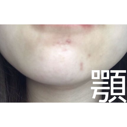 サンシビオ エイチツーオー D/ビオデルマ/クレンジングウォーターを使ったクチコミ(6枚目)