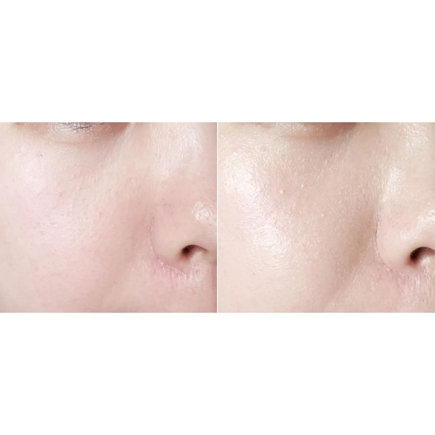 エッセンス スキングロウ ファンデーション/SHISEIDO/リキッドファンデーションを使ったクチコミ(3枚目)