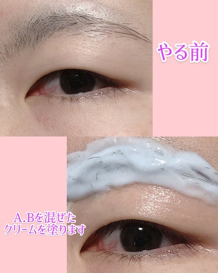 脱色クリーム 敏感肌用/エピラット/ムダ毛ケアを使ったクチコミ(5枚目)