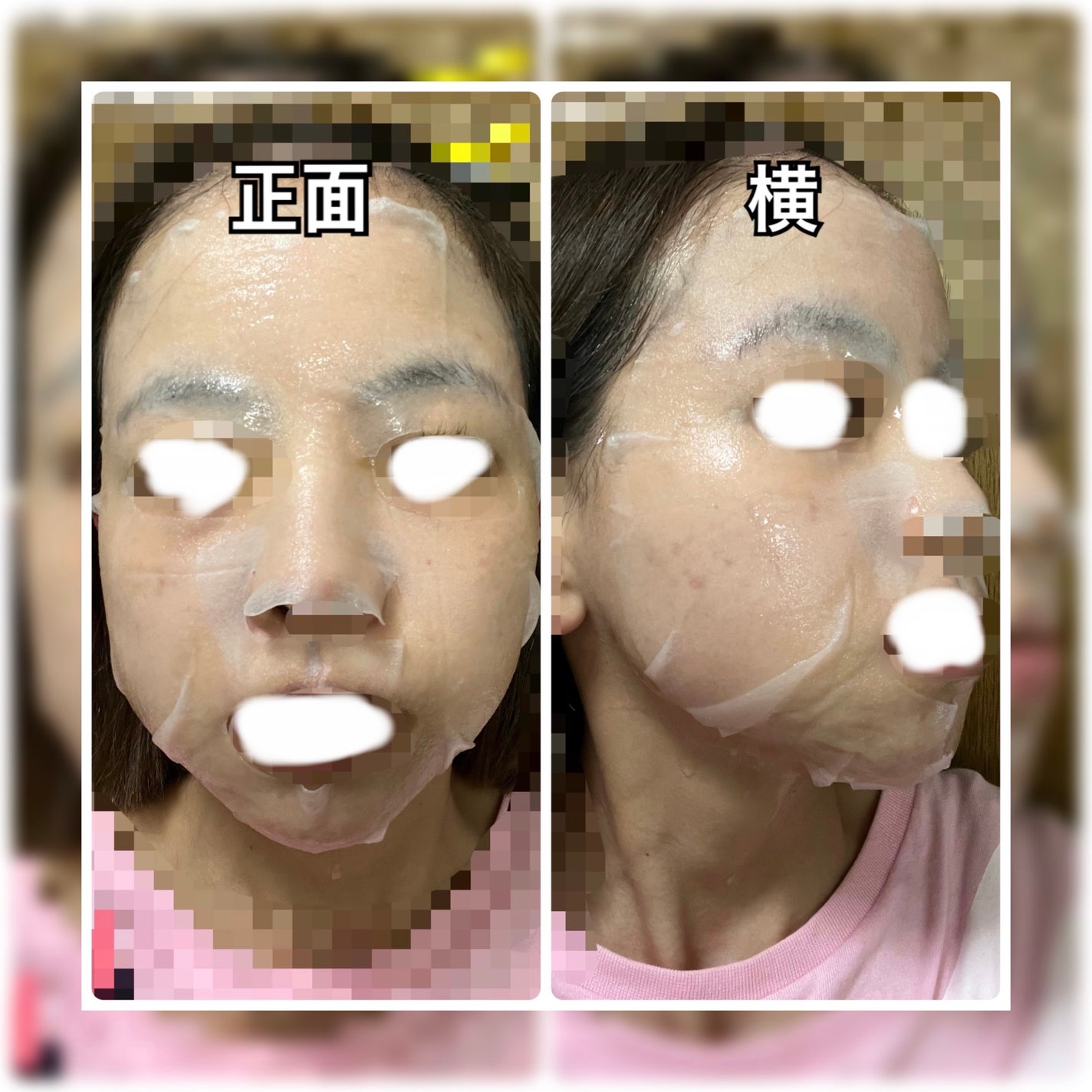 @aoi_lipsbeautyjp on LIPS ãðµmedicubeZEROPORECOOLINGMASKïœåç..ãïŒ2æç®ïŒ