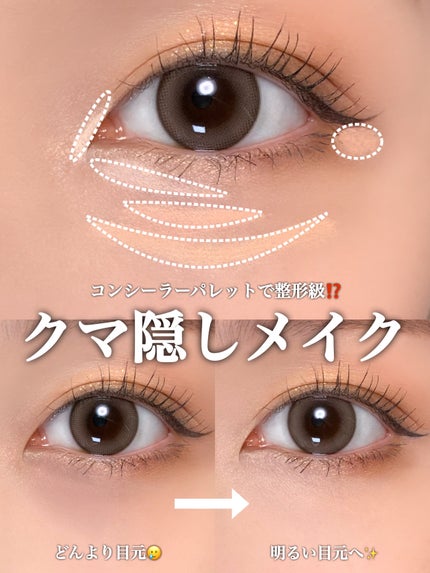 カラーミキシングコンシーラー/キャンメイク/パレットコンシーラーを使ったクチコミ(1枚目)