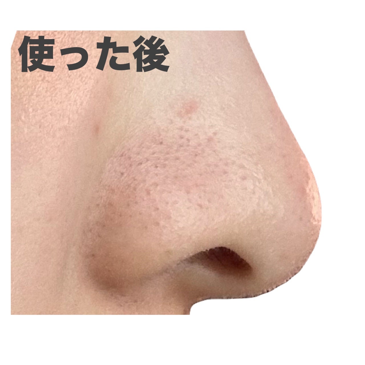 ゼロ毛穴パッド 2.0/MEDICUBE/トナーパッドを使ったクチコミ(7枚目)