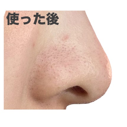 ゼロ毛穴パッド 2.0/MEDICUBE/トナーパッドを使ったクチコミ(7枚目)