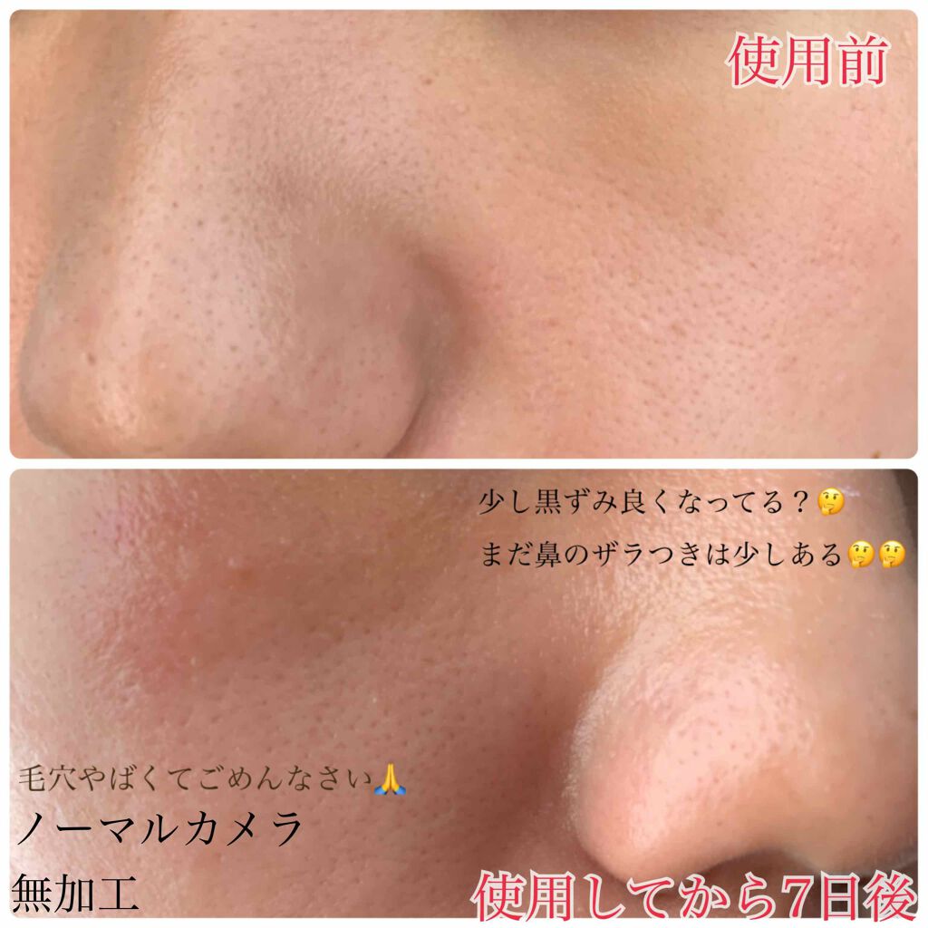 スーパー毛穴エッセンスローション/ラボラボ/化粧水を使ったクチコミ(3枚目)