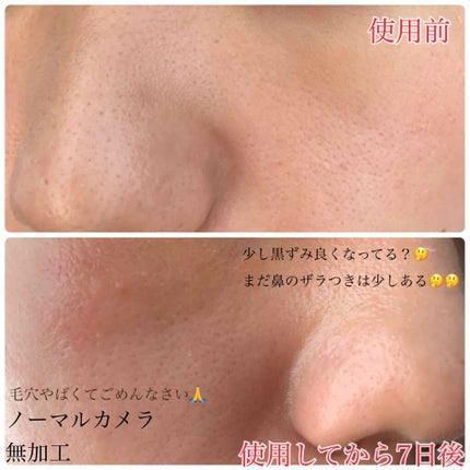 スーパー毛穴エッセンスローション/ラボラボ/化粧水を使ったクチコミ(3枚目)