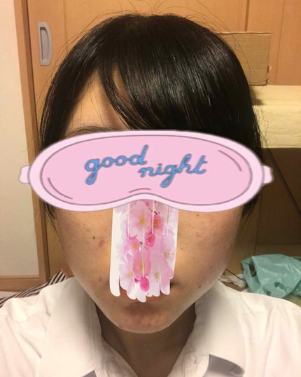 ディフェリンゲル0.1% /マルホ株式会社/その他を使ったクチコミ(2枚目)