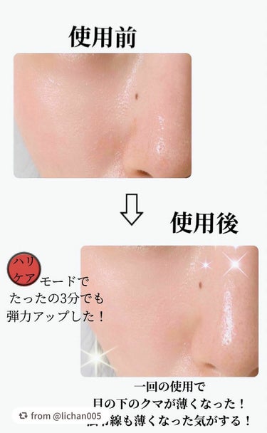 スキンライトセラピーII/Makeon/美顔器・マッサージを使ったクチコミ（7枚目）