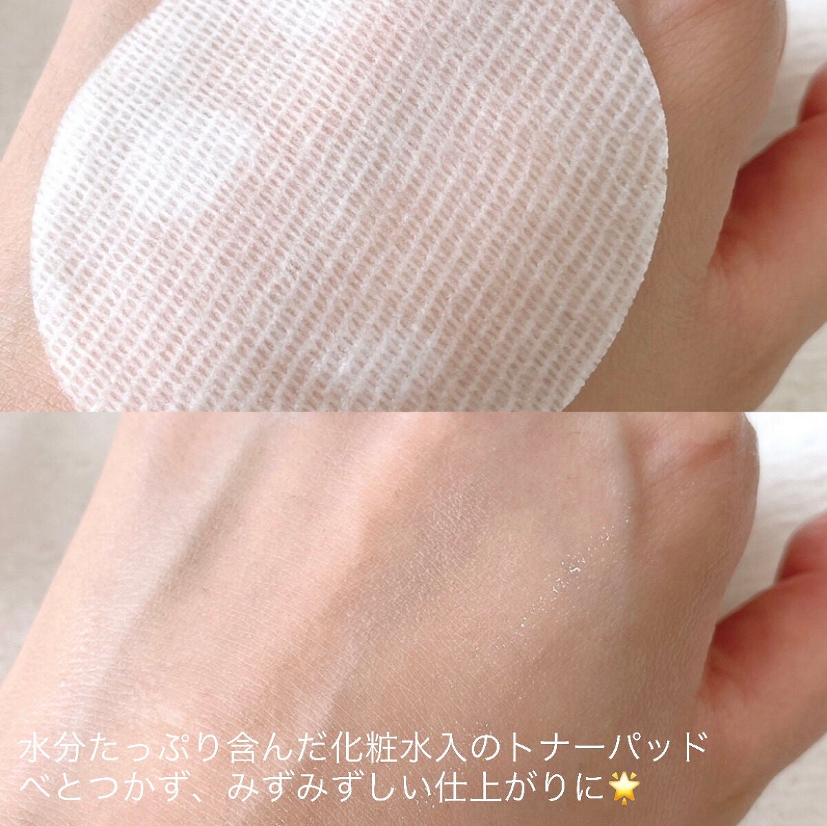 弱酸性pHシートマスク ドクダミフィット/Abib /シートマスク・パックを使ったクチコミ(4枚目)