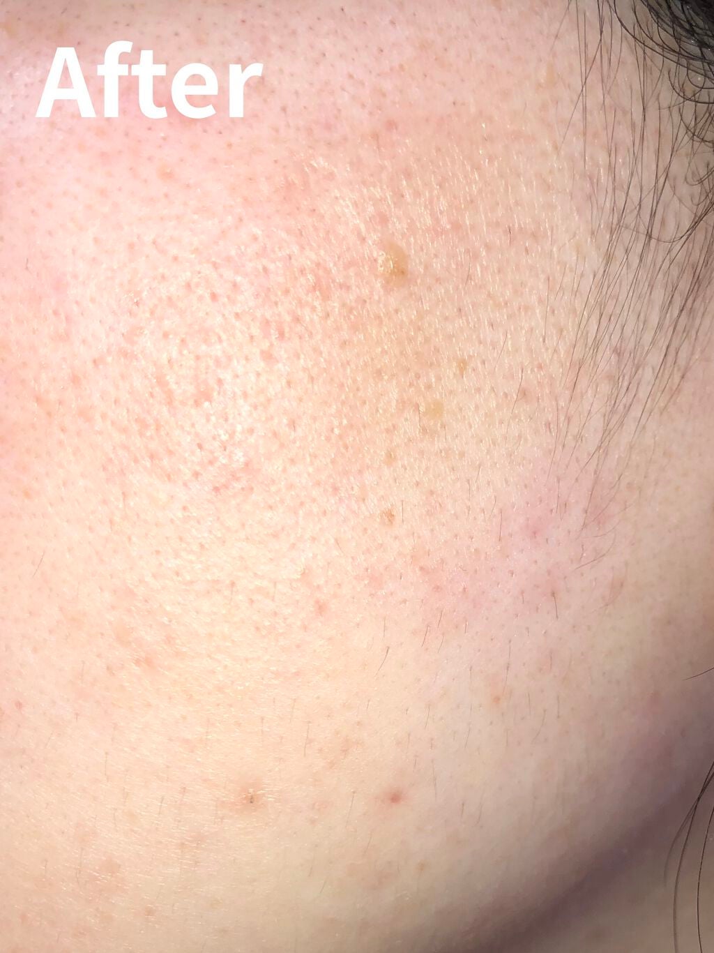 メラノショット ホワイト D/ONE BY KOSE/美容液を使ったクチコミ(3枚目)