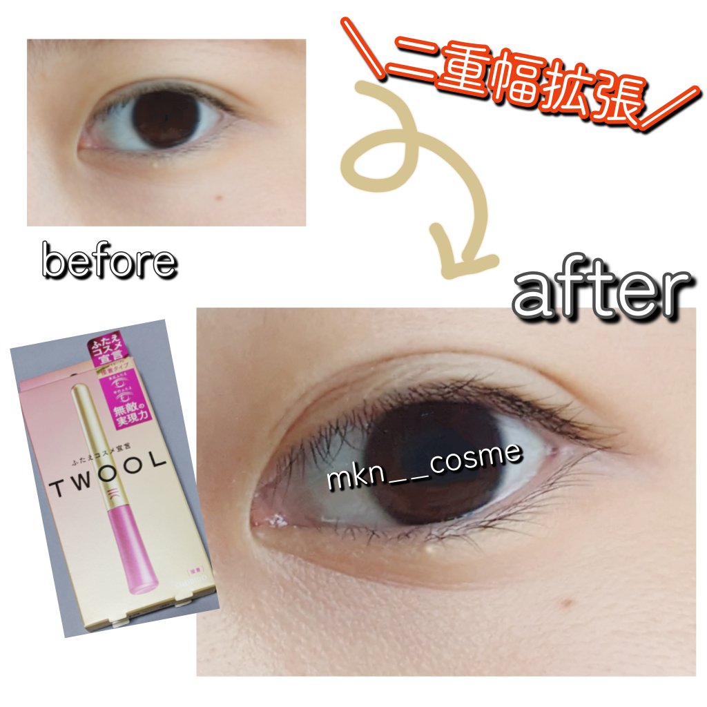 TWOOL ダブルアイリッドグルー/SHOBIDO/二重まぶた用アイテムを使ったクチコミ（1枚目）