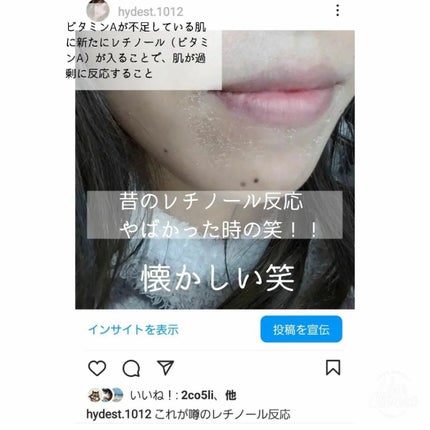 レチノショット 0.1/TOUT VERT/フェイスクリームを使ったクチコミ(6枚目)