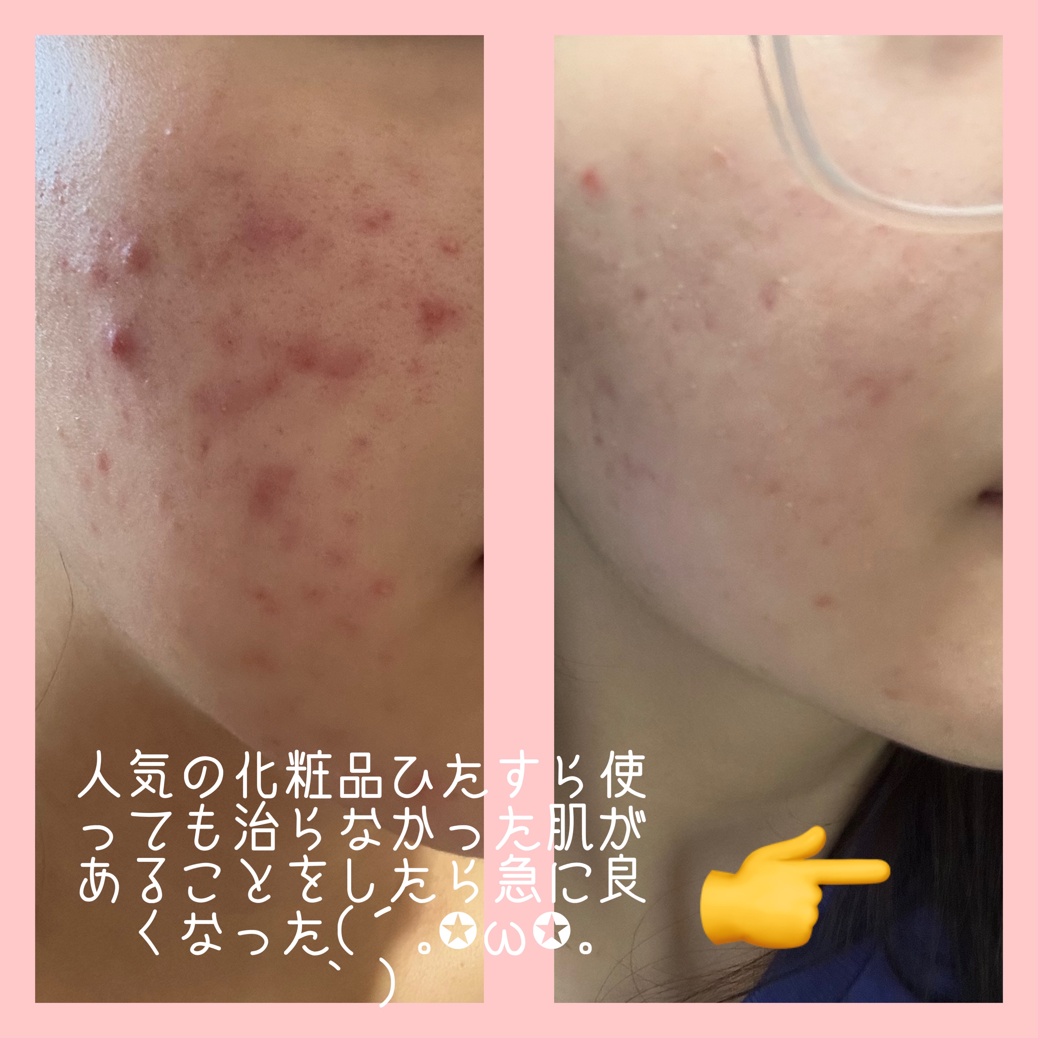 トリートメント クレンジング ミルク/COVERMARK/ミルククレンジングを使ったクチコミ（2枚目）