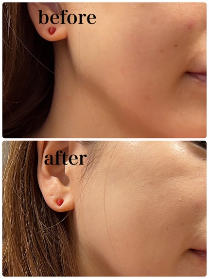 GO クッション/ヴァレンティノ ビューティ/クッションファンデーションを使ったクチコミ(2枚目)