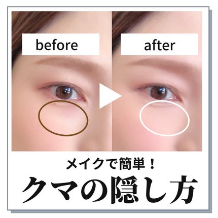 カラーミキシングコンシーラー/キャンメイク/パレットコンシーラーを使ったクチコミ(1枚目)