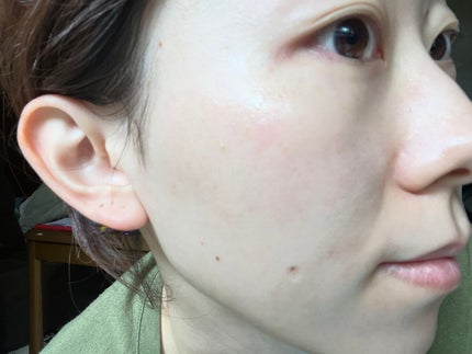 もちすべバランス化粧水/ボタニカルフォース/化粧水を使ったクチコミ(4枚目)