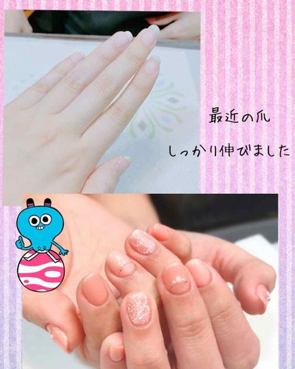 EB ボトルジェル トップ&ベース/eternal basic/ネイルトップコートを使ったクチコミ(1枚目)