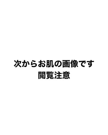 トランスペアレントフィニッシュパウダー/キャンメイク/プレストパウダーを使ったクチコミ（1枚目）