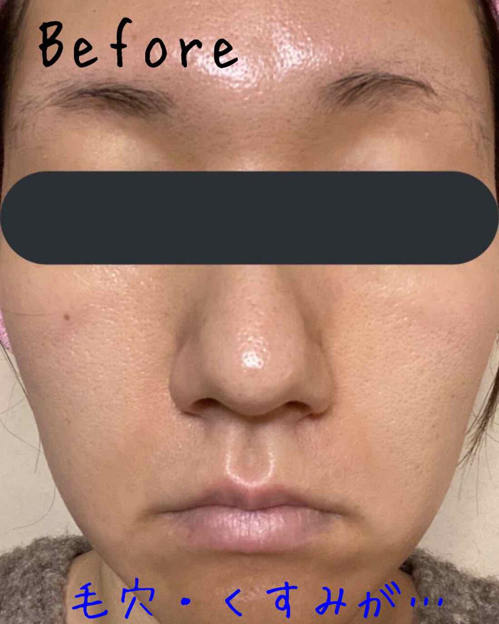 ヌードファンタジーホワイトニングクリーム / CHICAY CHICOの口コミ