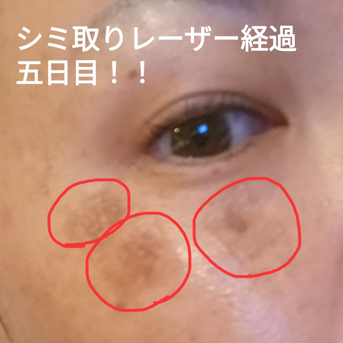 を使ったクチコミ（1枚目）