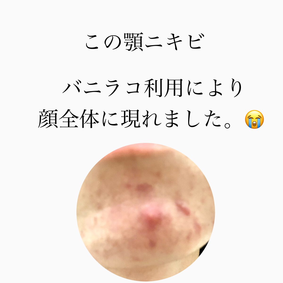 クリーンイットゼロ クレンジングバーム ナリシング/BANILA CO/クレンジングバームを使ったクチコミ（2枚目）