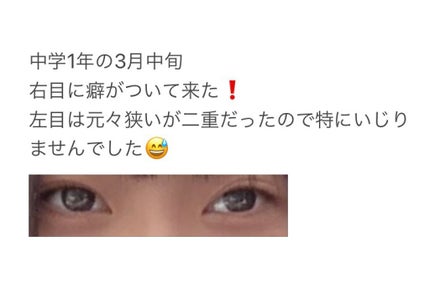 ヘアピン/LUCKY/ヘアアクセサリーを使ったクチコミ(5枚目)