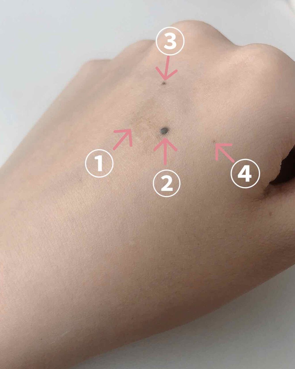 【旧】ディオールスキン フォーエヴァー スキン コレクト コンシーラー/Dior/リキッドコンシーラーを使ったクチコミ(3枚目)