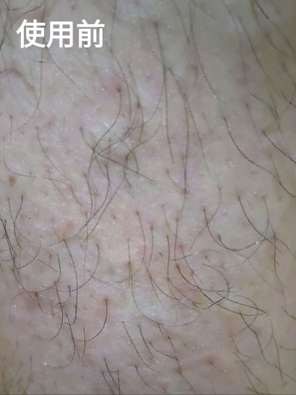 ミュゼコスメ メンズ 薬用ヘアリムーバルクリーム ホワイトシトラスの香り/ミュゼコスメ/除毛クリームを使ったクチコミ(4枚目)