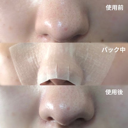 BHクリアノーズパック/CucuporeC/シートマスク・パックを使ったクチコミ(4枚目)