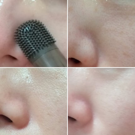 チョコブラ スペシャル毛穴ケアセット/Chocobra/スキンケアキットを使ったクチコミ(4枚目)