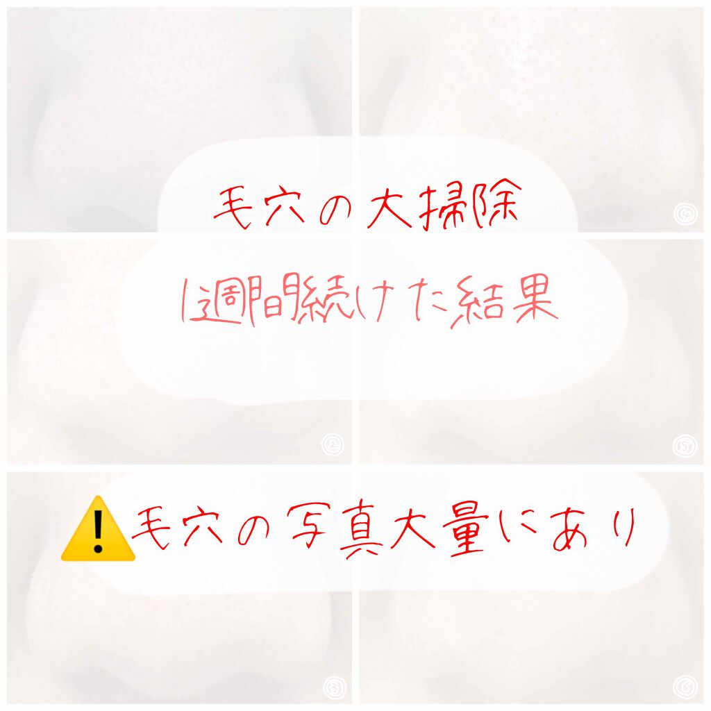 ベビーオイル 無香料/ジョンソンベビー/ボディオイルを使ったクチコミ(1枚目)