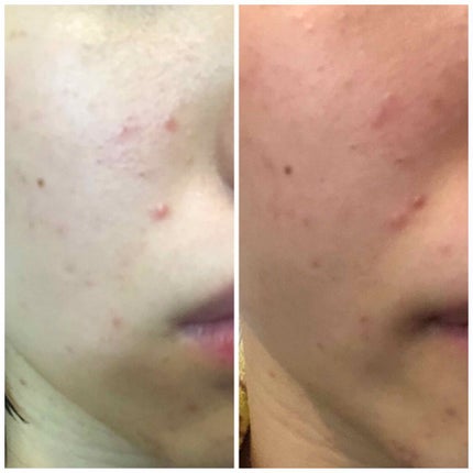 EclatCharme(エクラシャルム)/FABIUS/オールインワン化粧品を使ったクチコミ(3枚目)