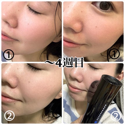 MiRAY/MYTREX/美顔器・マッサージを使ったクチコミ(6枚目)