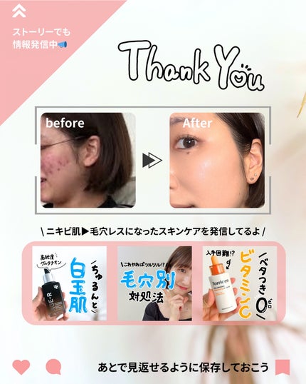 薬用しみ対策 美白化粧水/メラノCC/化粧水を使ったクチコミ(10枚目)