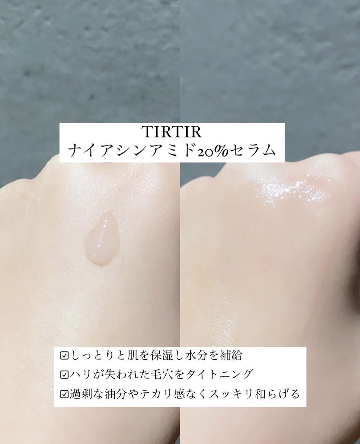 NIACIN 20% ã»ã©ã /TIRTIR(ãã£ã«ãã£ã«)/çŸå®¹æ¶²ã䜿ã£ãã¯ãã³ãïŒ2æç®ïŒ