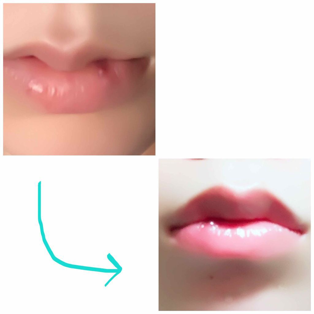 ハニーフルリップ HM/カントリー&ストリーム/リップ美容液を使ったクチコミ（1枚目）