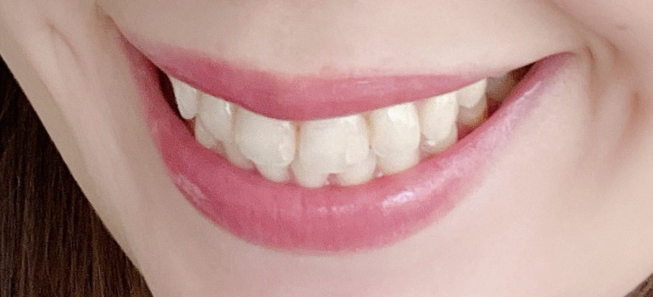 エレガンス ブリリアント ルージュ ビジュー 04/Elégance/リップグロスを使ったクチコミ（1枚目）