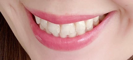 エレガンス ブリリアント ルージュ ビジュー/Elégance/リップグロスを使ったクチコミ(1枚目)