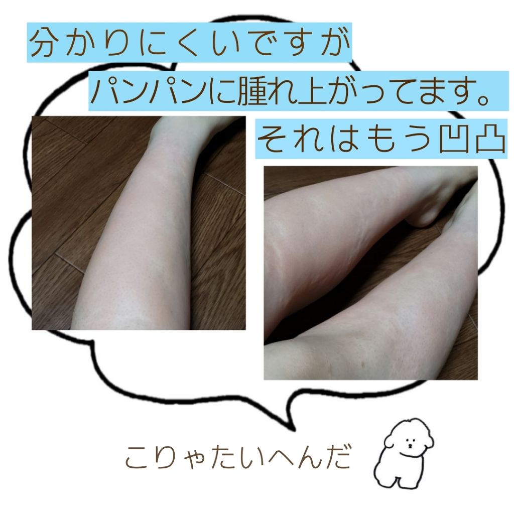 除毛ミルク/スリンキータッチ/除毛クリームを使ったクチコミ(2枚目)