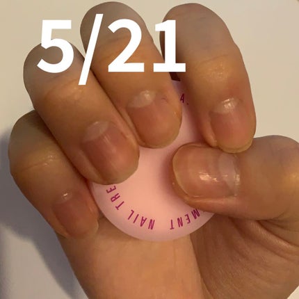 ネイルトリートメント N/ネイルネイル/ネイルオイル・トリートメントを使ったクチコミ(2枚目)