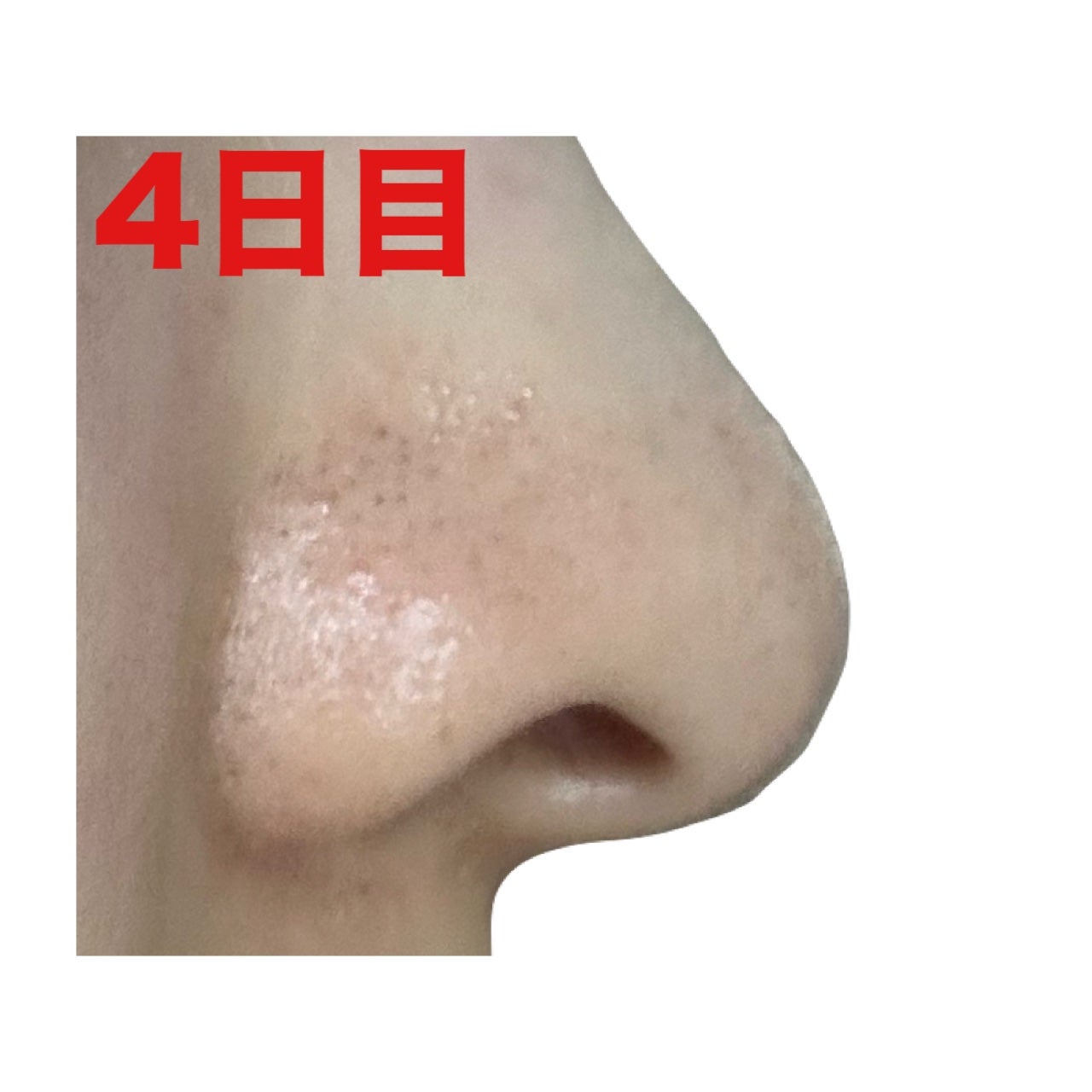 泥ジェル洗顔/ファンケル/その他洗顔料を使ったクチコミ(7枚目)