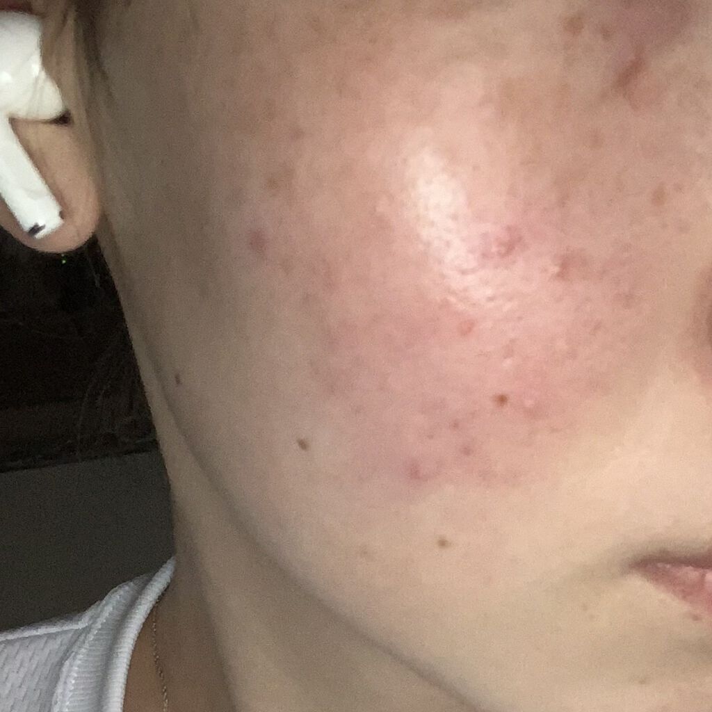 白潤 薬用美白化粧水(しっとりタイプ)/肌ラボ/化粧水を使ったクチコミ（2枚目）