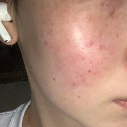 乳液・敏感肌用・高保湿タイプ/無印良品/乳液を使ったクチコミ(2枚目)