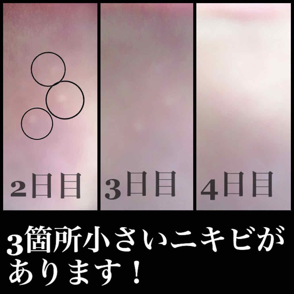 ビタB ACコントロールクリーム/SKIN&LAB/フェイスクリームを使ったクチコミ(2枚目)