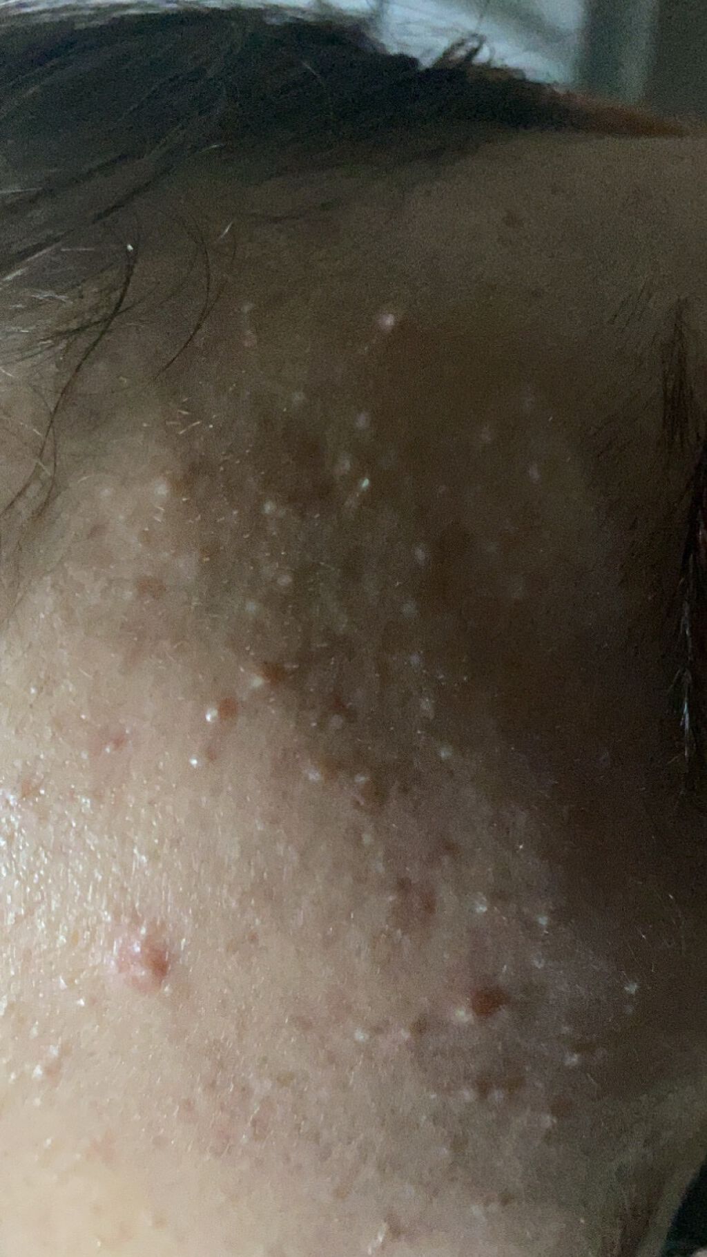 薬用パウダー化粧水/メンソレータム アクネス/化粧水を使ったクチコミ（2枚目）