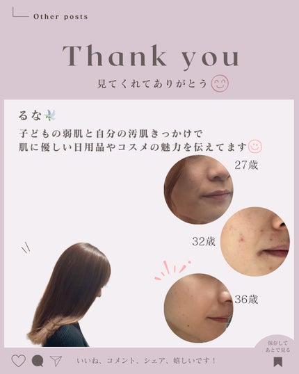 ããã³ ã¢ããã¢ã€ã¹ã ãšã€ãžã³ã°ã±ã¢ ãã€ã¯ãªãŒã UV/ããã³/æ¥çŒãæ¢ãã¯ãªãŒã ã䜿ã£ãã¯ãã³ãïŒ6æç®ïŒ