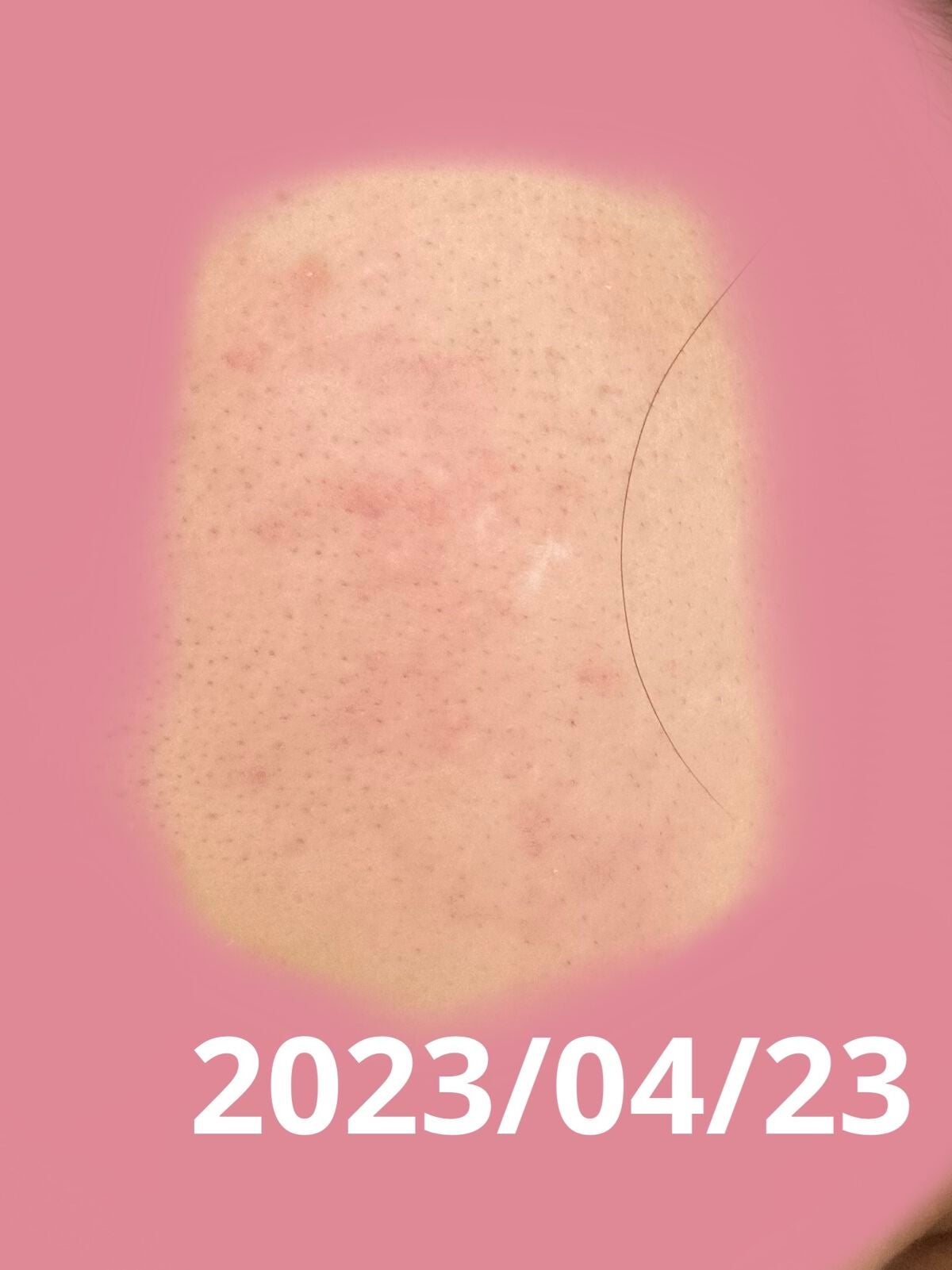 薬用しみ対策 美白化粧水 しっとりタイプ/メラノCC/化粧水を使ったクチコミ(2枚目)