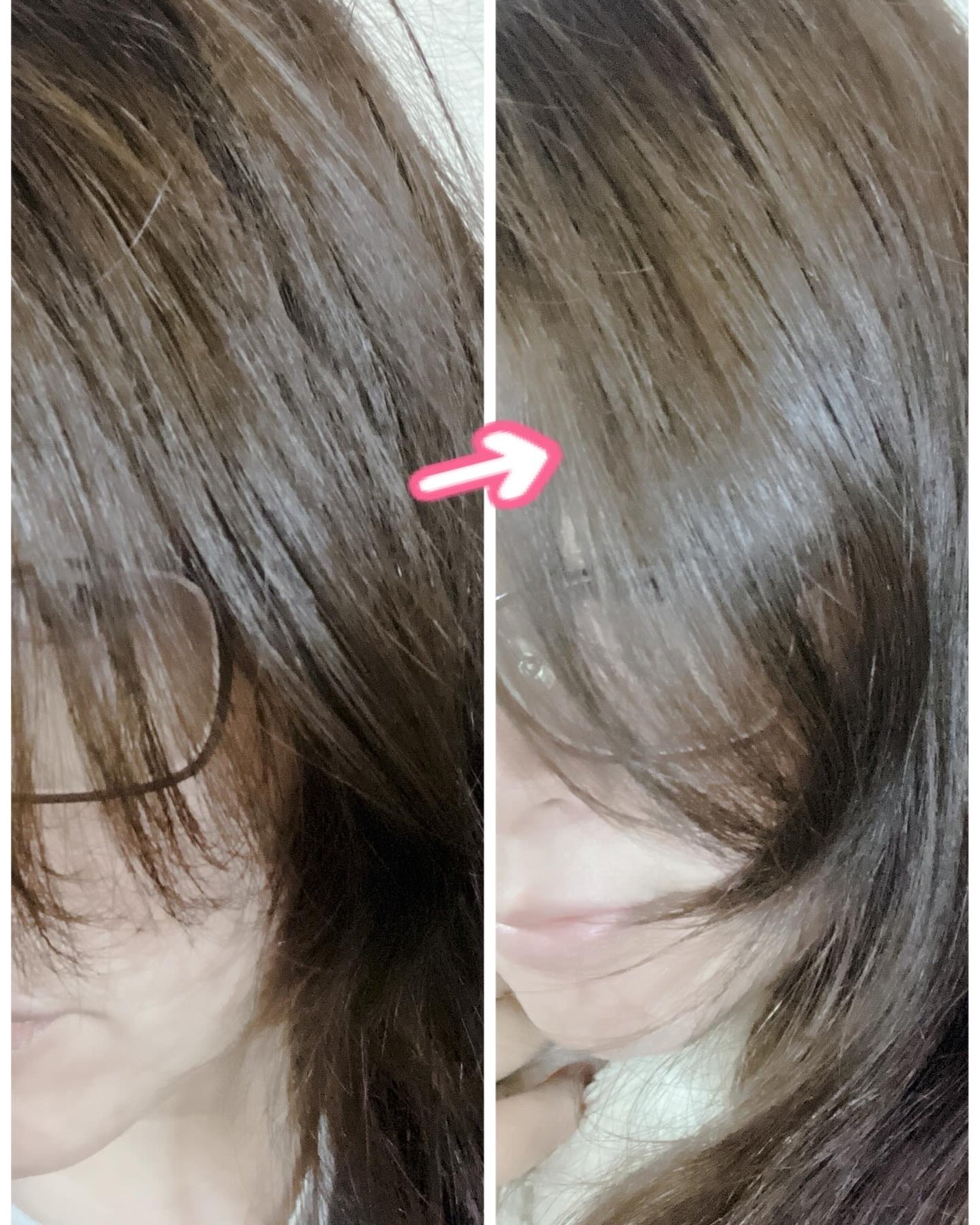ぷえら on LIPS 「モエブヘアケア抜け毛&ダメージケアに特化したアヌカチンシャンプ..」(5枚目)