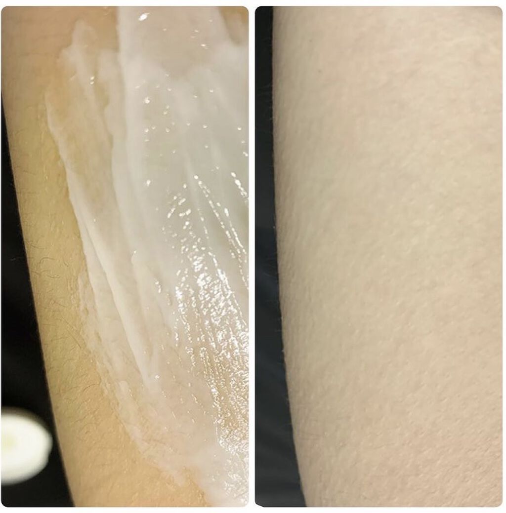 ミュゼコスメ メンズ 薬用ヘアリムーバルクリーム ホワイトシトラスの香り/ミュゼコスメ/除毛クリームを使ったクチコミ（3枚目）