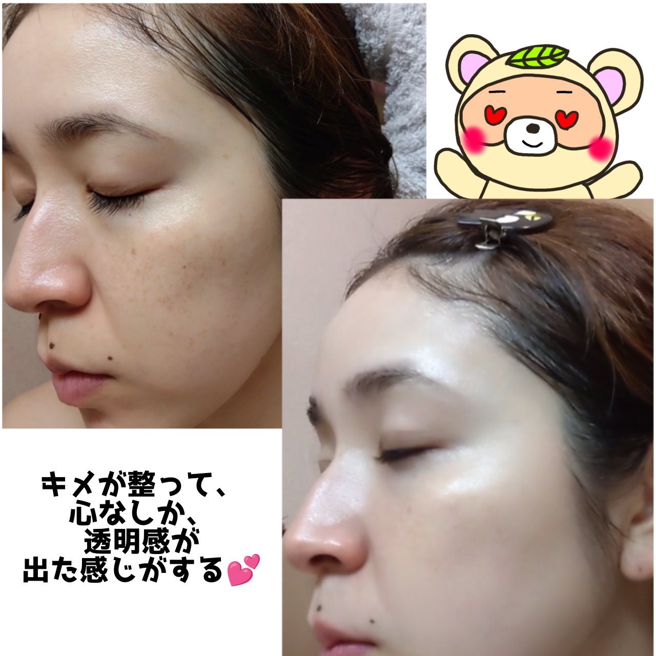 Toami リンクレスホワイトオールインワンジェル/Toami/オールインワン化粧品を使ったクチコミ（3枚目）